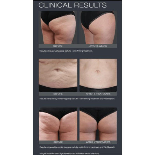 ASAP Cellulite and Skin Firming Treatment 200ml